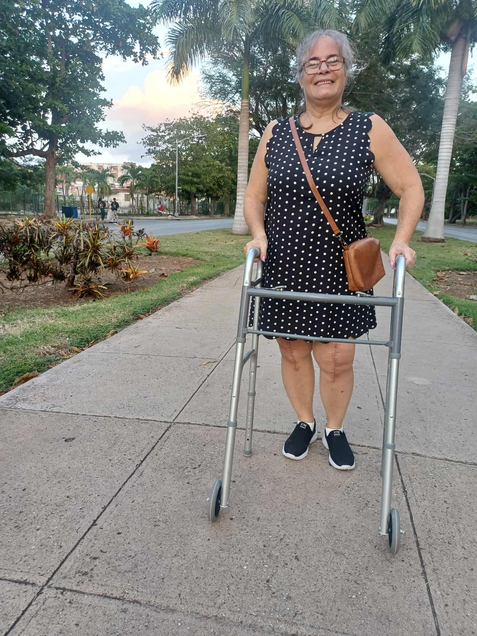 Tania 1 month after surgery